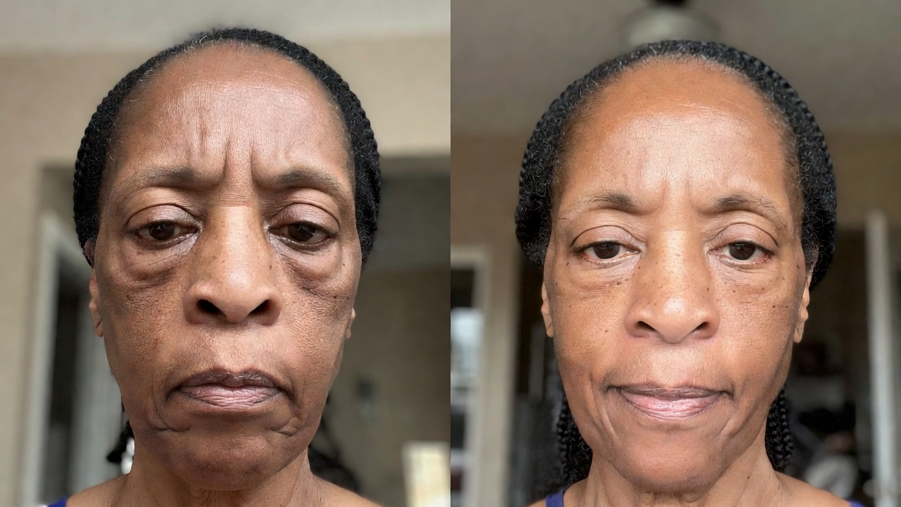 Member before and after 7 days